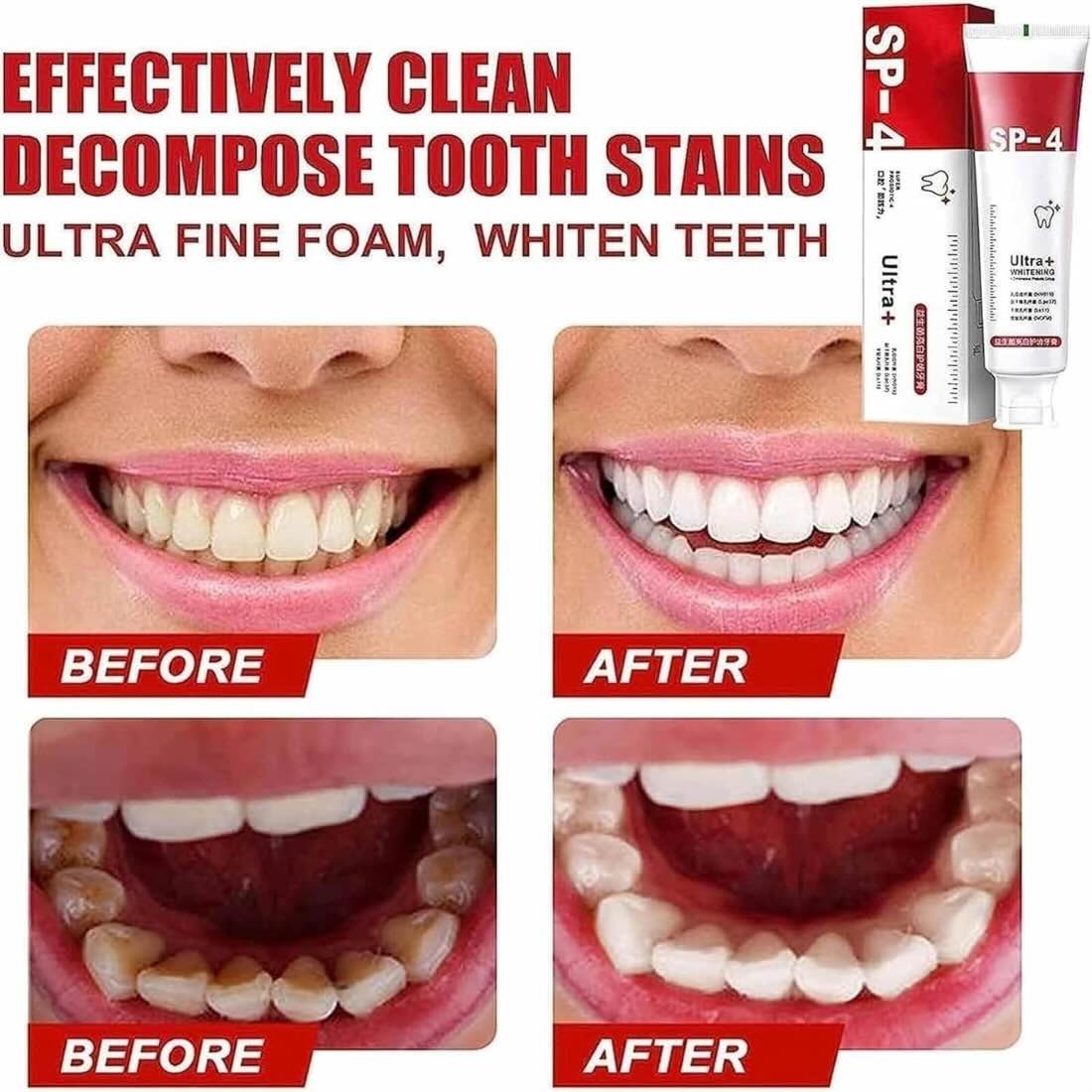 Yayashi SP-4 Ultra Whitening Toothpaste - Image 4