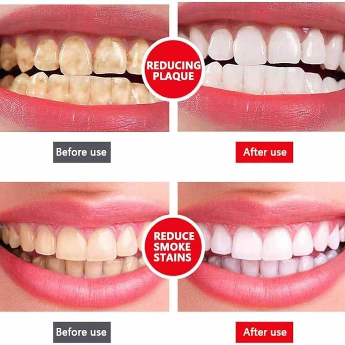 Yayashi SP-4 Ultra Whitening Toothpaste - Image 2